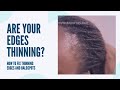 How to fix thinning edges and bald spots