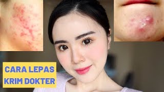 7 CARA LEPAS DARI KRIM DOKTER TANPA BREAKOUT (PENGALAMANKU)