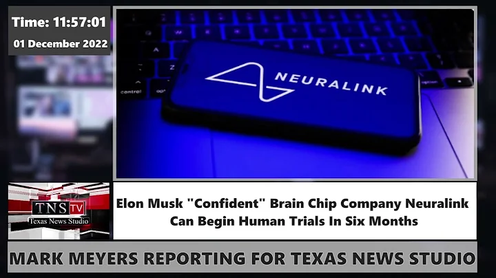 Elon Musk "Confident" Brain Chip Company Neuralink Can Begin Human Trials In Six Months