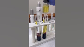 Pulling Plasma for a PRP #plasma #plateletrichplasma #prp #satisfying