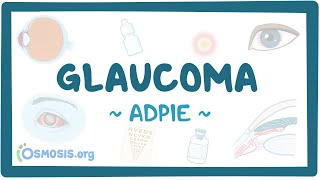 Glaucoma: Nursing Process