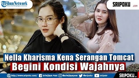 Nella Kharisma Kena Serangan Tomcat, Begini Kondisi Wajahnya