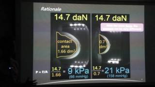 Improving mechanical breast compression in mammography