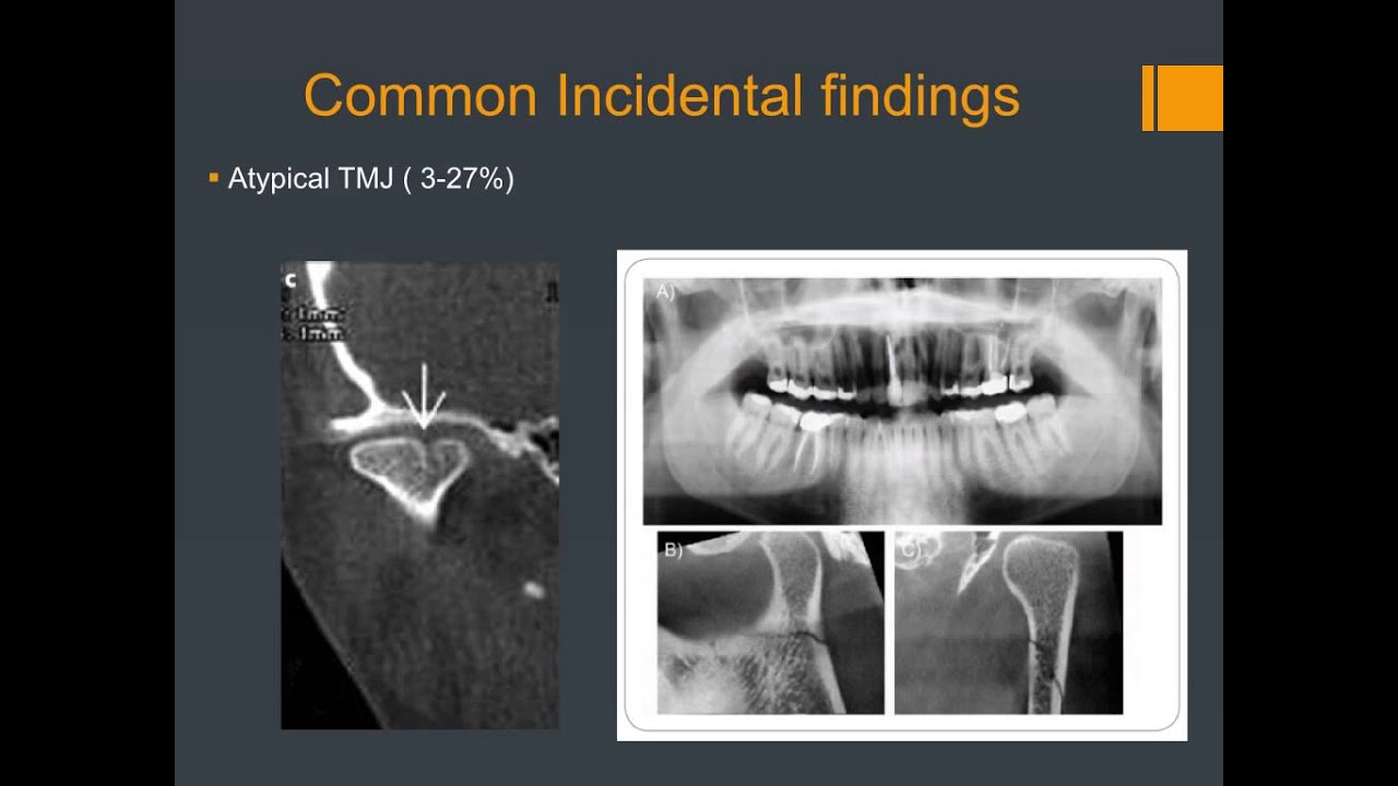Carestream Dental CBCT in Orthodontics YouTube