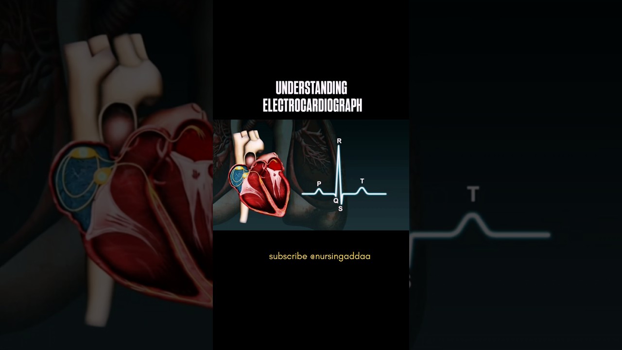 ECG Demystified: A Nurse’s Guide to Heart Rhythms