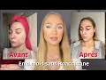 Acn et cicatrice  les erreurs  ne pas faire et les solutions sans roaccutane  skincare routine