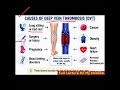 What Causes DVT? Deep Vein Thrombosis Explained in English Urdu | Nursing Lecture