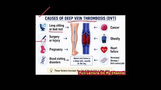 What Causes DVT? Deep Vein Thrombosis Explained in English Urdu | Nursing Lecture