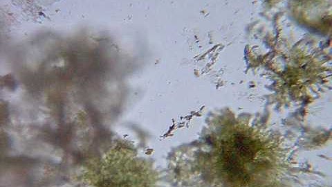 microscopic algae creatures