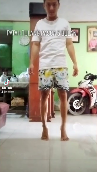 patah tulang paha sebalah kanan sudah 5 bulan