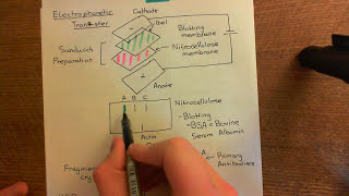 The Western Blot Part 3