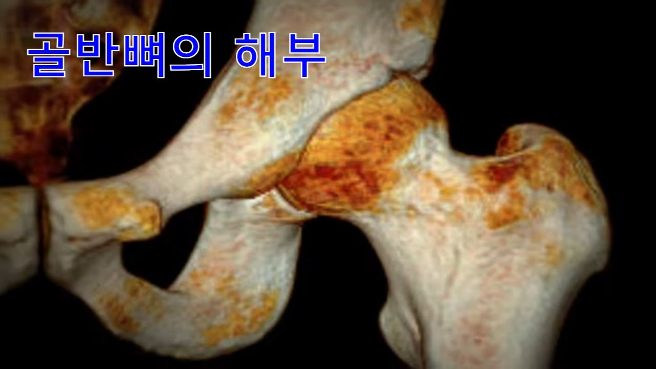 장골뼈 해부학이야기] 골반/Pelvis, 관골/볼기뼈/Hip