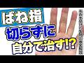 【ばね指】原因 は？自分でなおす！切らない 治療 を徹底解説（症状・ストレッチ・腱鞘炎・注射）