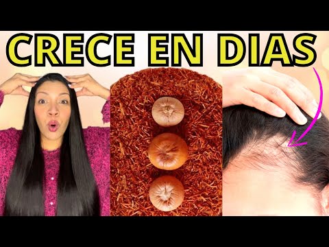 Video: 6 formas sencillas de saber si está creciendo cabello nuevo