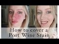 How to cover a Port Wine Stain birthmark