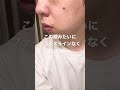 口呼吸を無意識に続けた結果…
