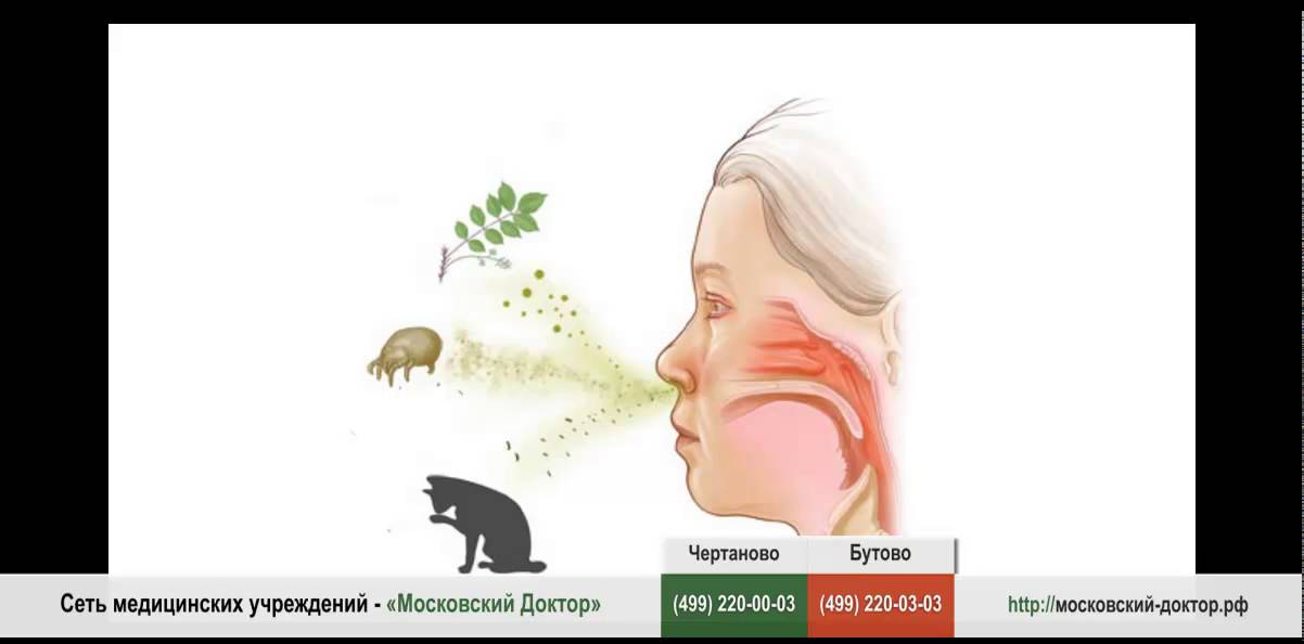 Аллергический ринит