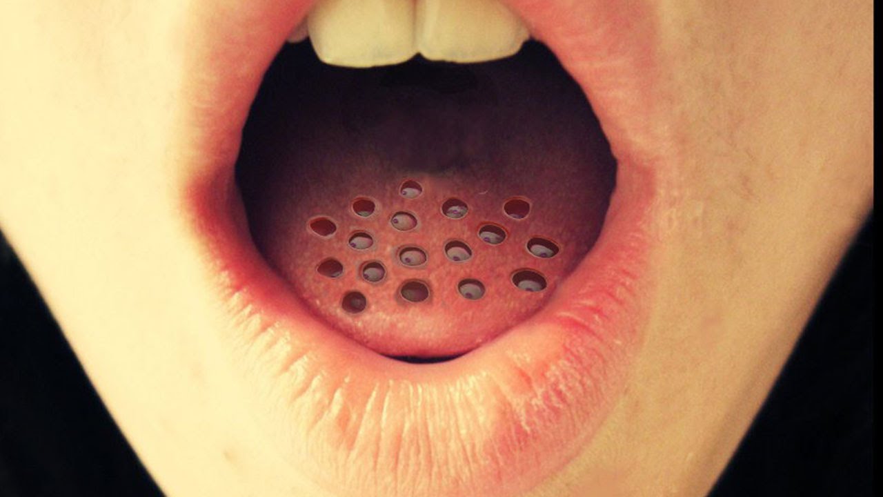 10 САМЫХ НЕЛЕПЫХ ФОБИЙ