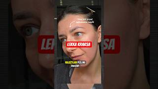 Co zrobić, jak zmyjesz peeling kwasowy i masz czerwoną skórę?