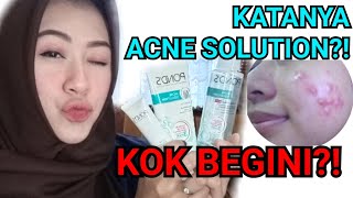 Review POND'S Juice Collection Gel Cream Moisturizer | Ester Wijaya