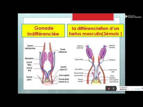 Vidéo: Troubles Du Développement Sexuel: Enseignements Tirés Du Séquençage Génique Ciblé D'une Large Cohorte Internationale De Patients