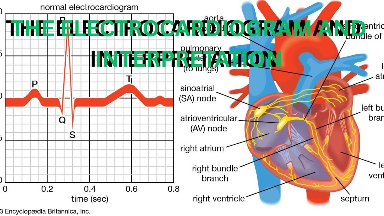ECG/EKG Interpretation Made Easy! | Electrocardiogram Explained for Medical & Nursing Students