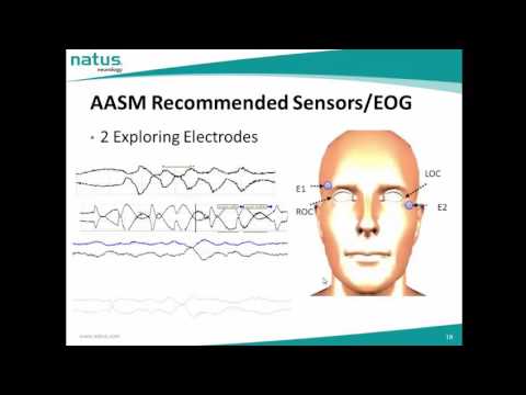 AASM Recommended and Alernative sensors in PSG - YouTube