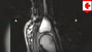 Исследователи сделали МРТ хруста суставами пальцев