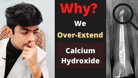 Why We Over-extend Calcium Hydroxide | Is This Right or Wrong?| Let