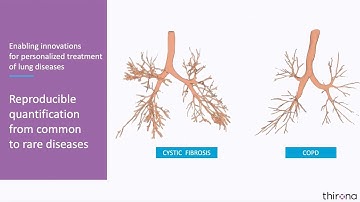 LungQ™ precise quantification of common and rare diseases