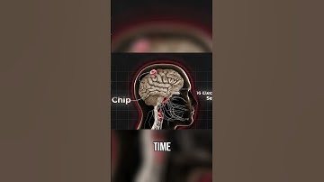 Discover the Future of Brain Computer Interfaces  Neuralink