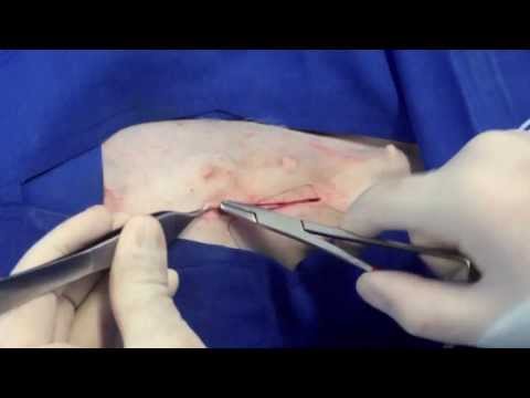 Video: Ovariohisterectomía Versus Ovariectomía