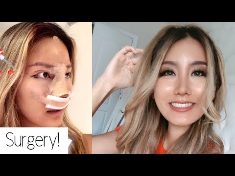 I got Plastic Surgery in Korea! ID Hospital | PART 1