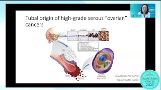 Identifying & Addressing Drivers in Ovarcoming Ovarian Cancer