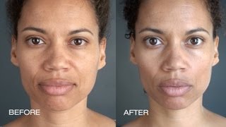 Cosmetic Acupuncture - The Natural Facelift