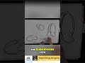 Master IVC View: Subxiphoid Technique for POCUS #shorts