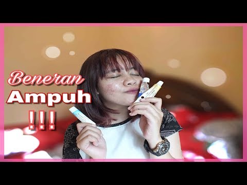 Obat Jerawat untuk Cystic acne (jerawat batu) dan bruntusan