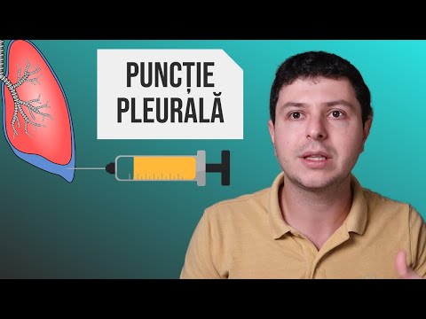 Video: Pericardita Restrictivă: Simptome, Cauze și Tratament