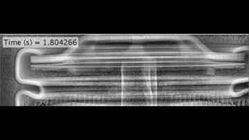 High-speed X-ray imaging: Rupture of an LG 18650 Li-ion cell