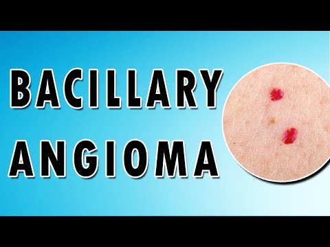 Cat Scratch Disease - Bacillary Angioma