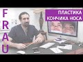 Пластика кончика носа: самые популярные вопросы