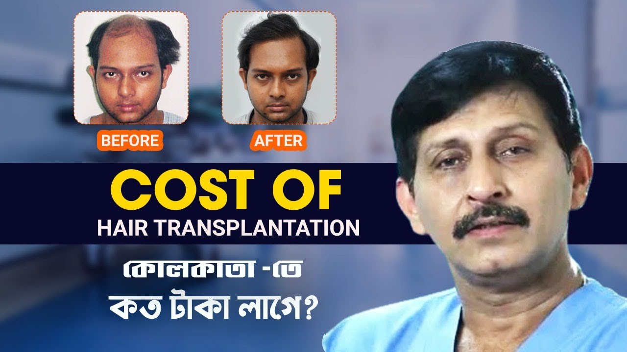 Hair Transplant in Kolkata Best Results & Cost of Hair Transplant in