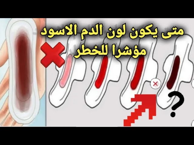 لماذا يكون الحيض أسود ومتى يكون مؤشرًا على الخطر؟