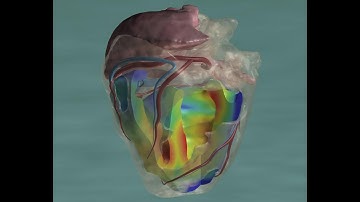 Abaqus Bio-Mechanical full lecture- Seven Hours modeling and simulation contains twelve lectures
