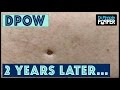 Flip it Reverse it Blackhead Extraction Dilated Pore of Winer