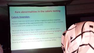 Caloric Test Procedures & Interpretation. Prof. Dr. Adel Abdel Maksoud (2)