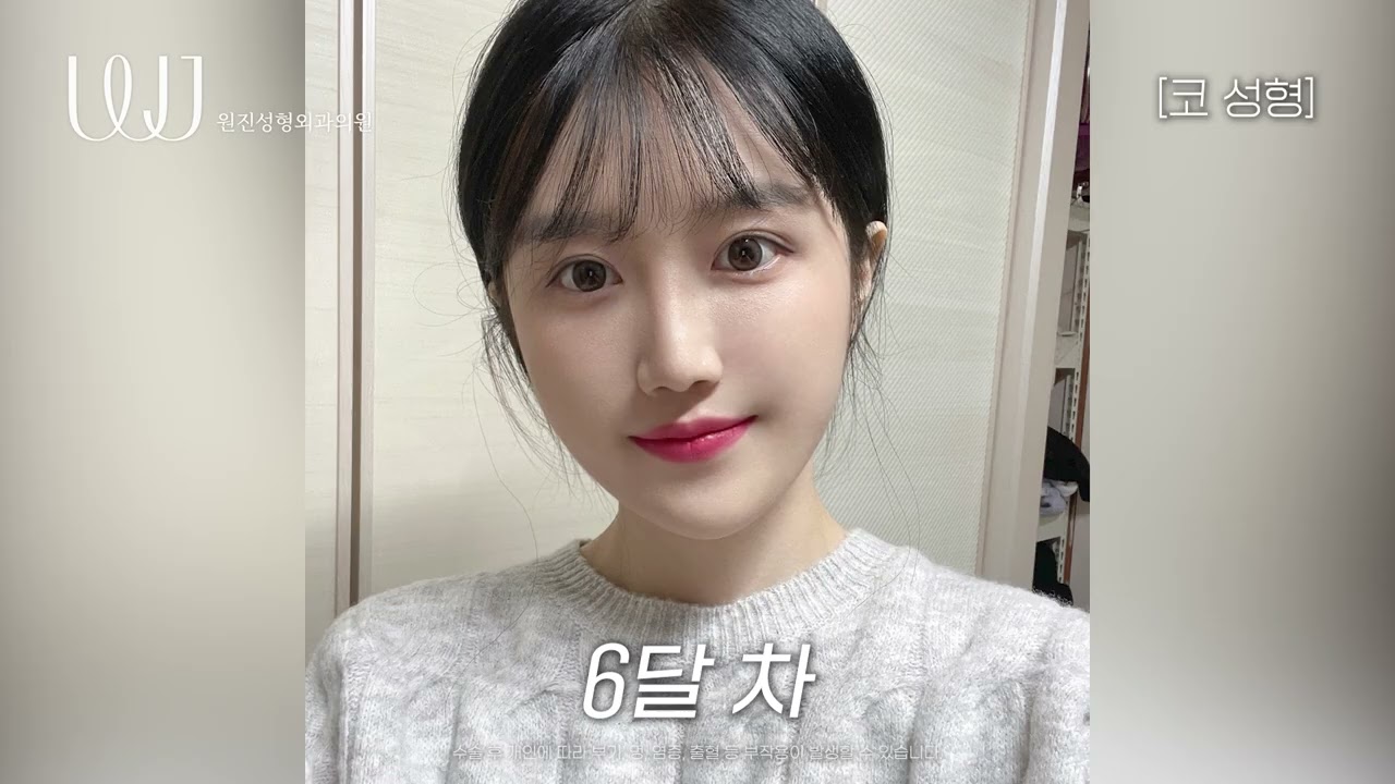 [Вонжин Гоо Сайхны Мэс Заслын Эмнэлэг] Ийм учраас хамрын мэс засал хийлгэдэг юм байна˚ෆ*₊💛