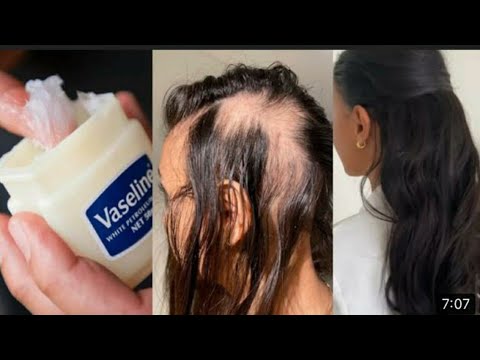 Vidéo: La vaseline est-elle bonne pour les cheveux ?