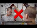 Best FUE Hair Transplant - Unshaven FUE & Long Hair Transplant Possible in 2024