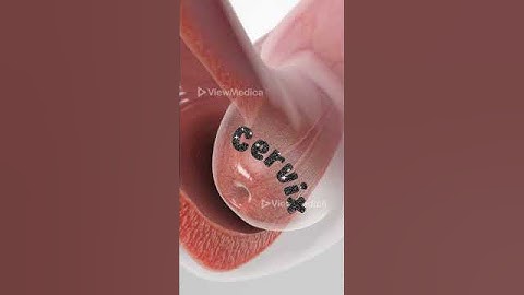 Pap Smear (3D Animation)